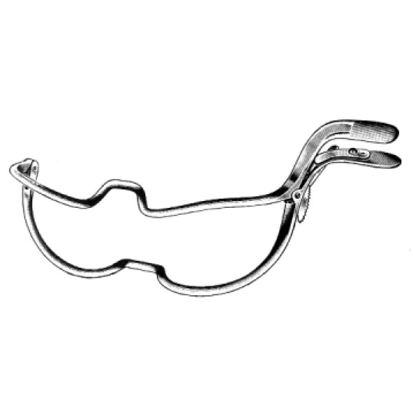 Jenning Mouth Gag 15cm