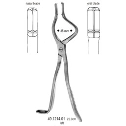 Disimpaction Fcps left 35mm, 23cm
